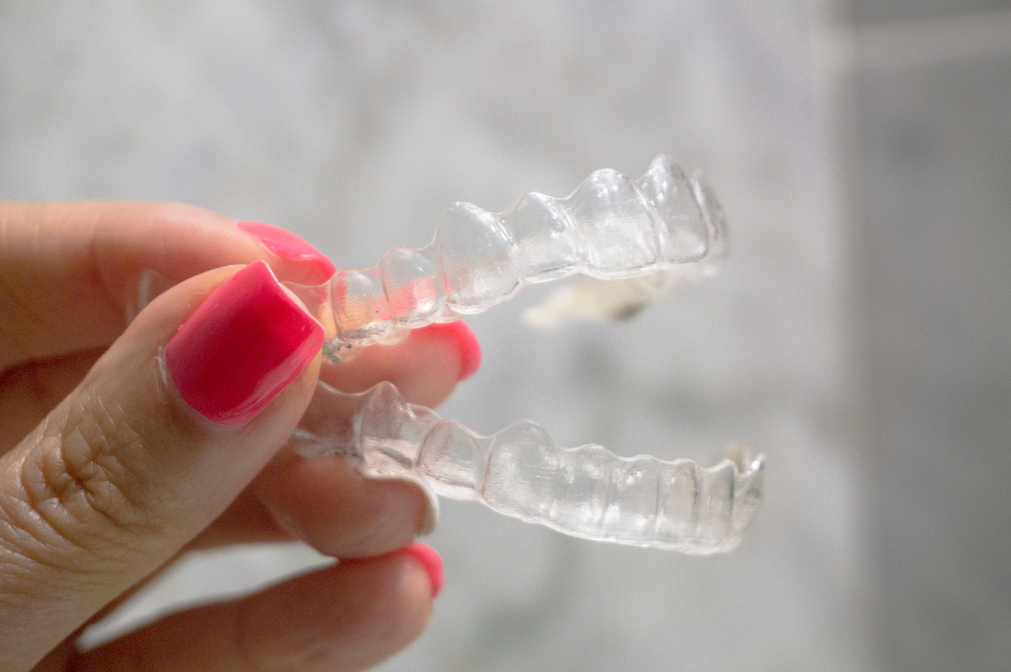 Invisalign cena ni bila težava